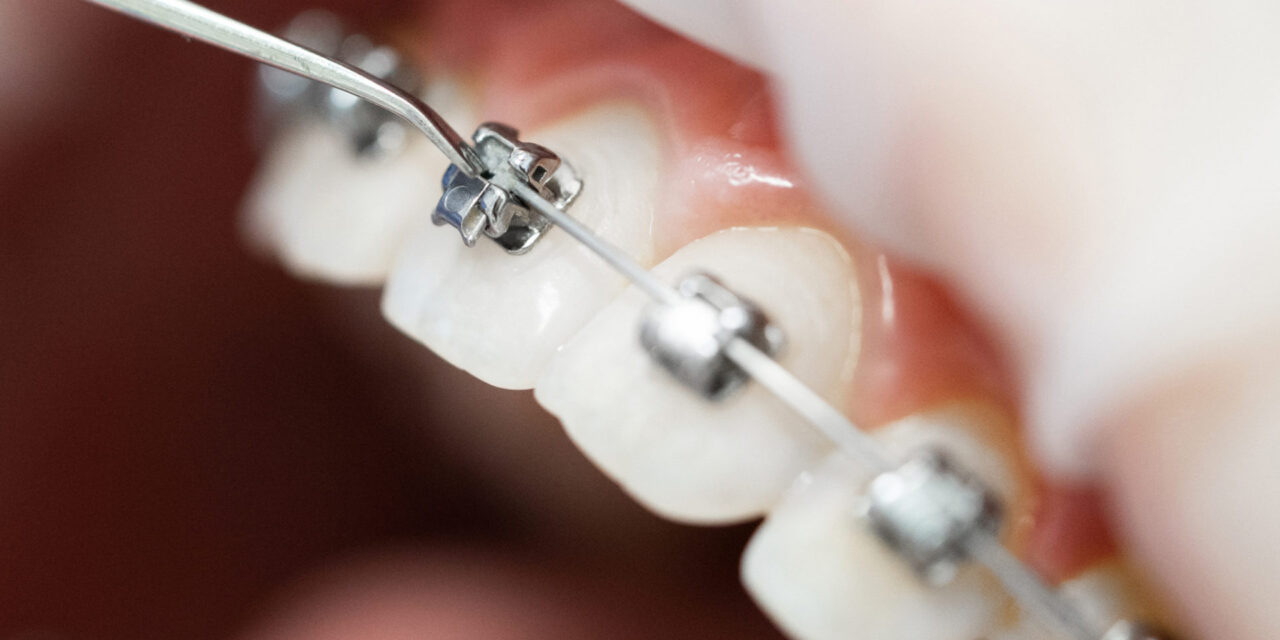Orthodontist Near Me