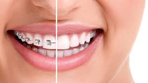 Transform Your Smile