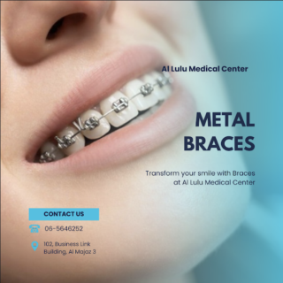 Lulu Invisalign Sharjah