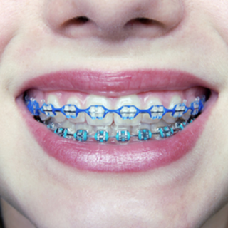 lulu-orthodontist